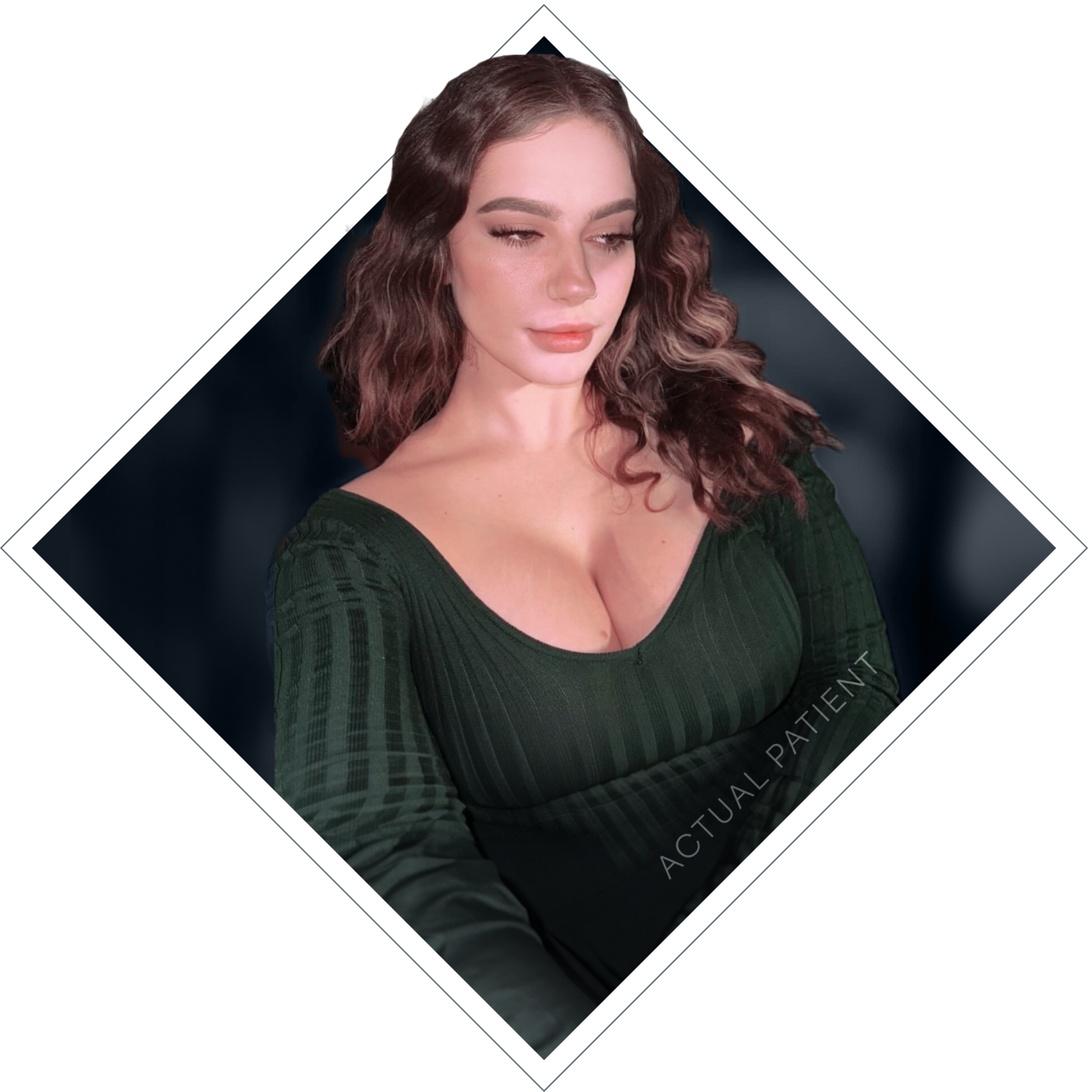 woman in green dress who underwent breast augmentation