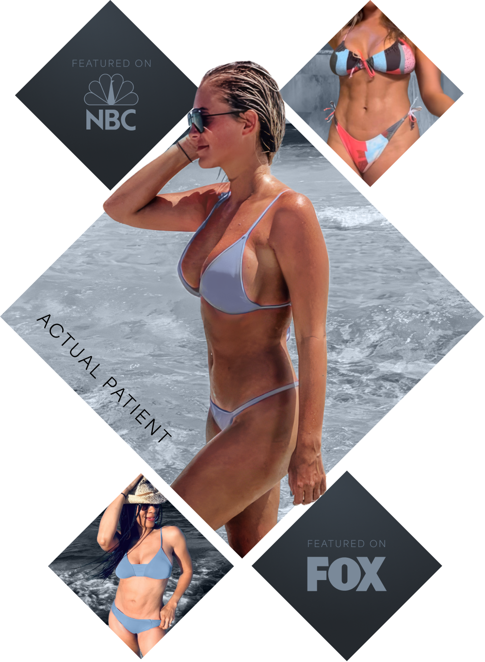 Houston plastic surgeon Cain Linville's patient results