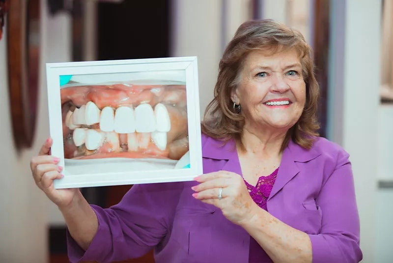 NuSmile Patient holding their before picture and smiling showing their after-smile
