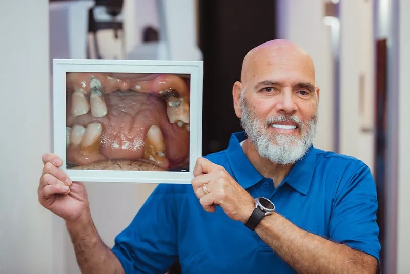 NuSmile Patient: Doug, holding his before picture and smiling showing his after-smile