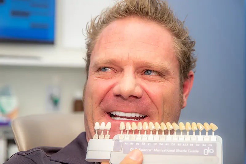 NuSmile patient with veneer options