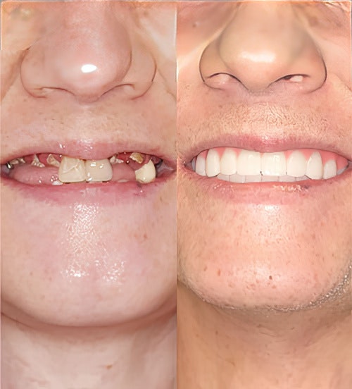 A real patient's before and after results