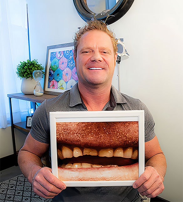 Real patient before and after