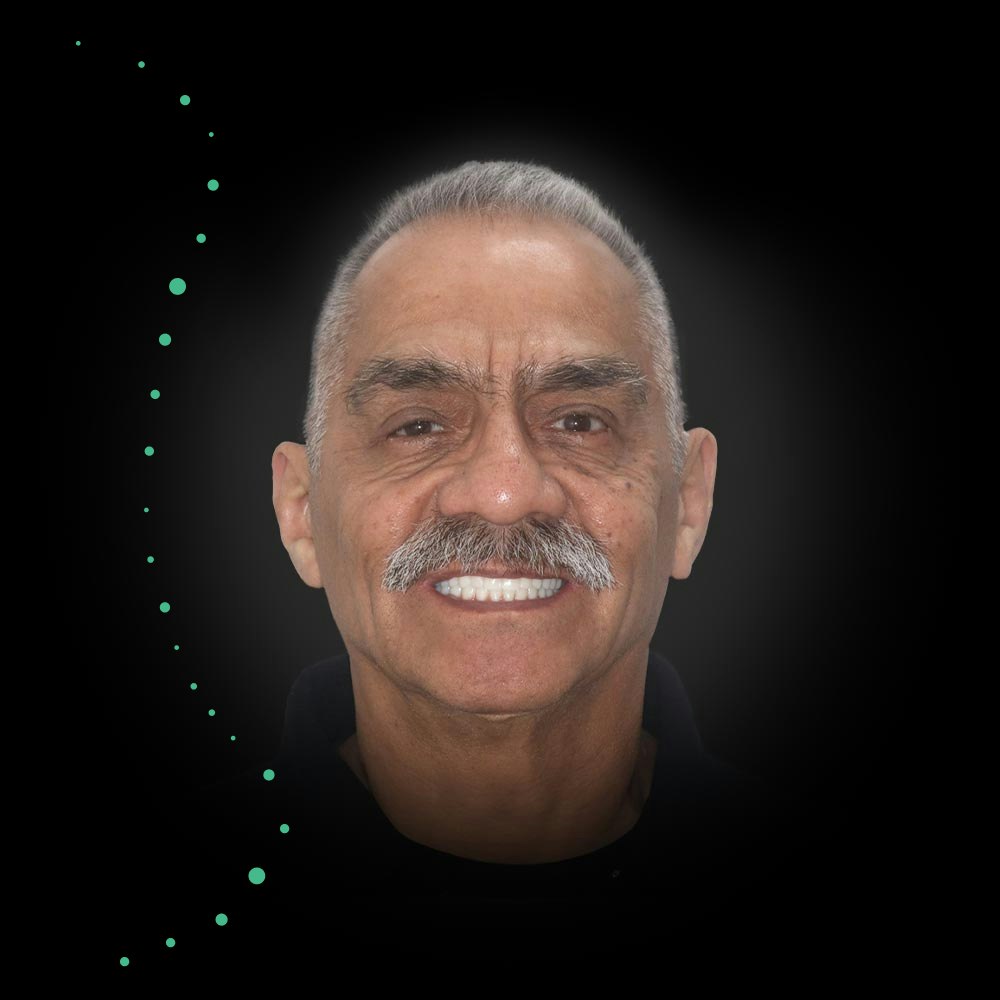 Smiling man with All-on-4 implants