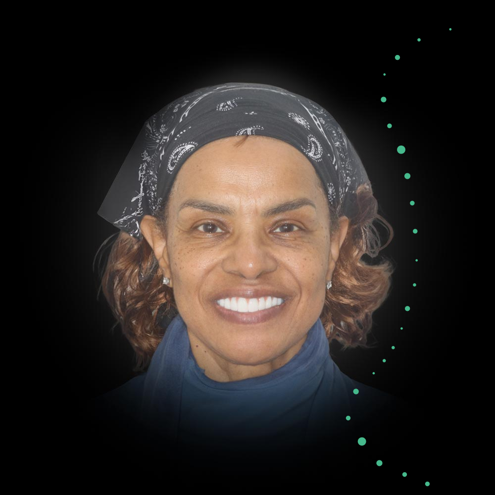 Smiling woman after a smile makeover