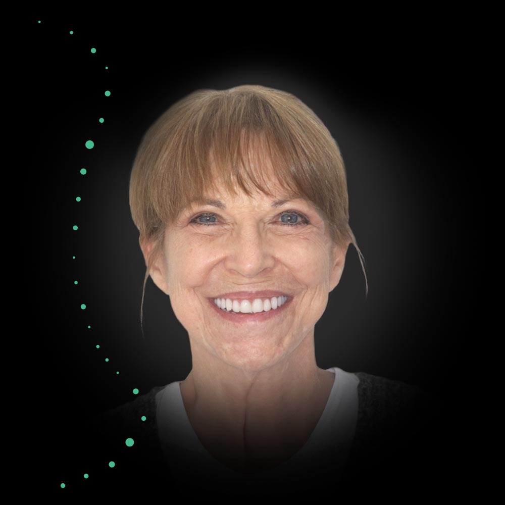 Smiling man after veneer treatment