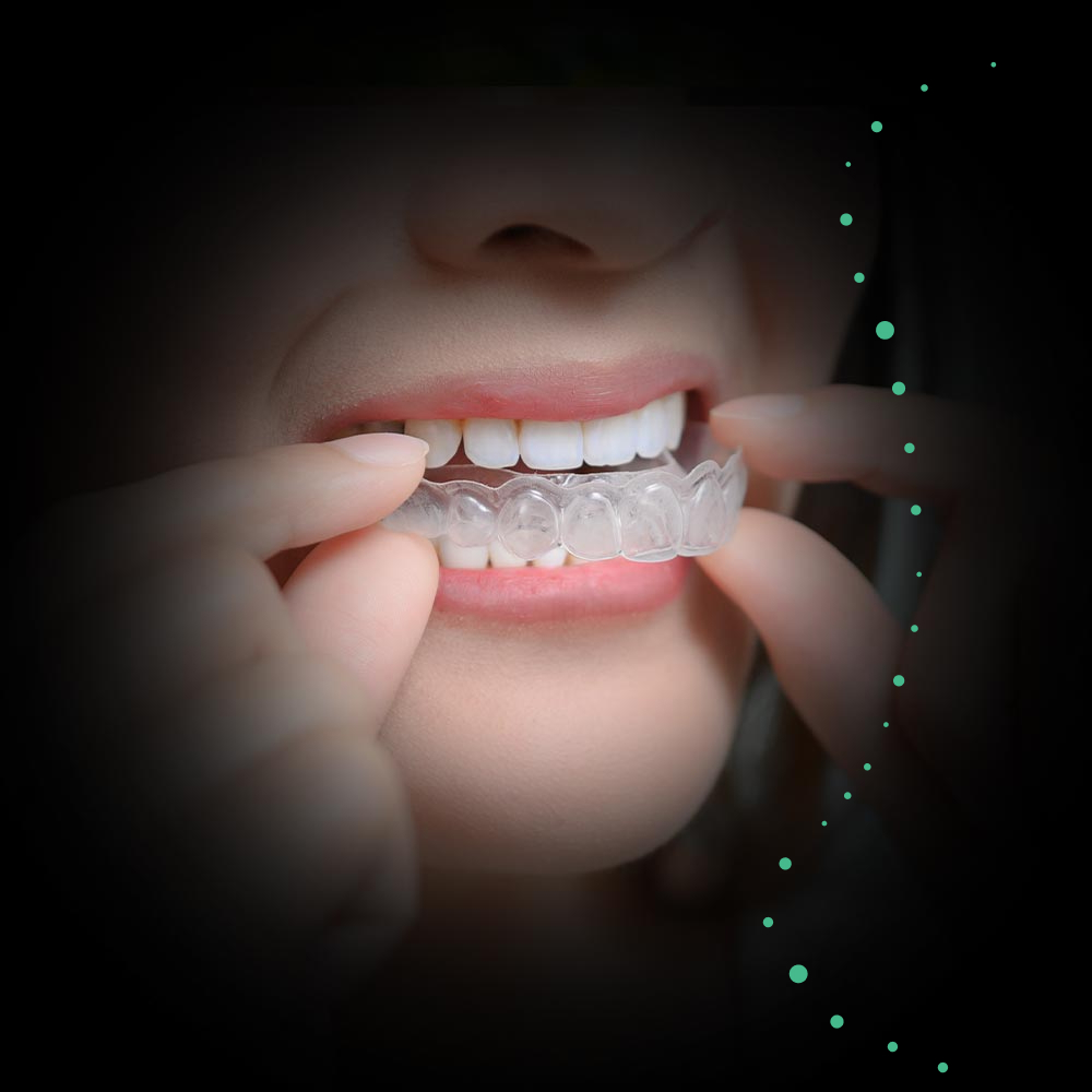 woman putting on invisalign tray