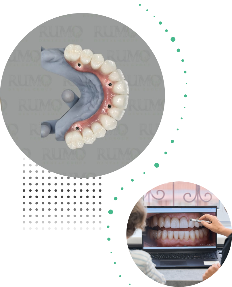 collage of denture and patient case on a screen