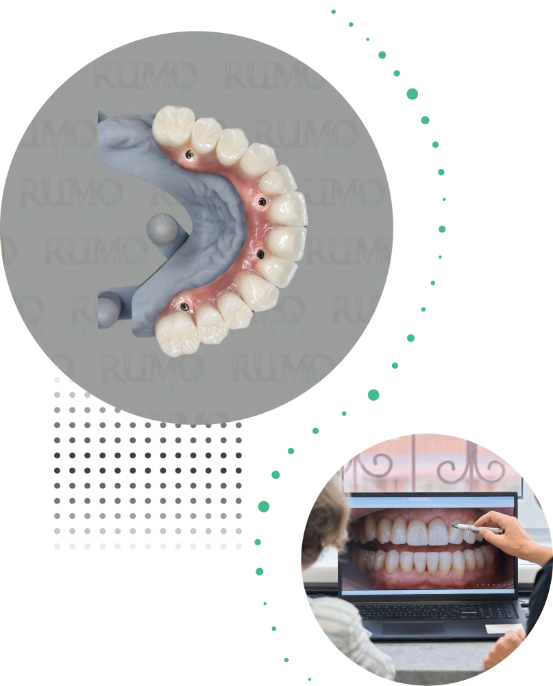 collage of denture and patient case on a screen