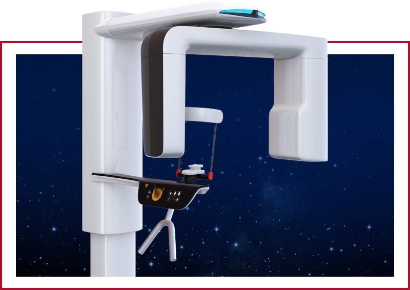 3D cone-beam scanner