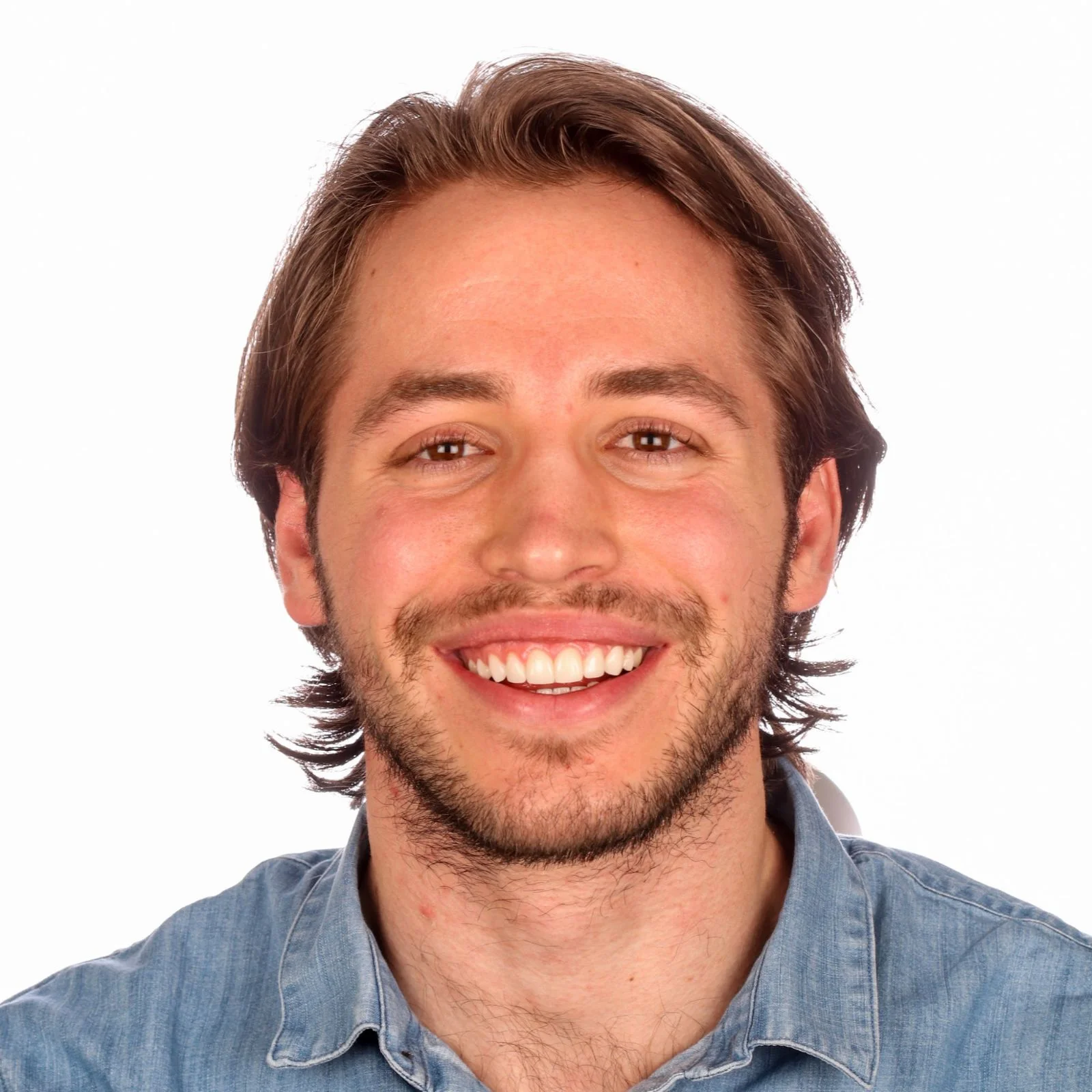 Dental Veneers St. Louis Smile On Dental Studio Dr. Chris Hill