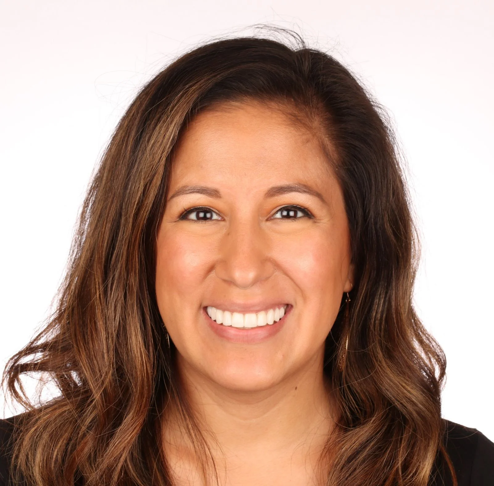 No Prep Veneers St. Louis, MO Smile On Dental Studio