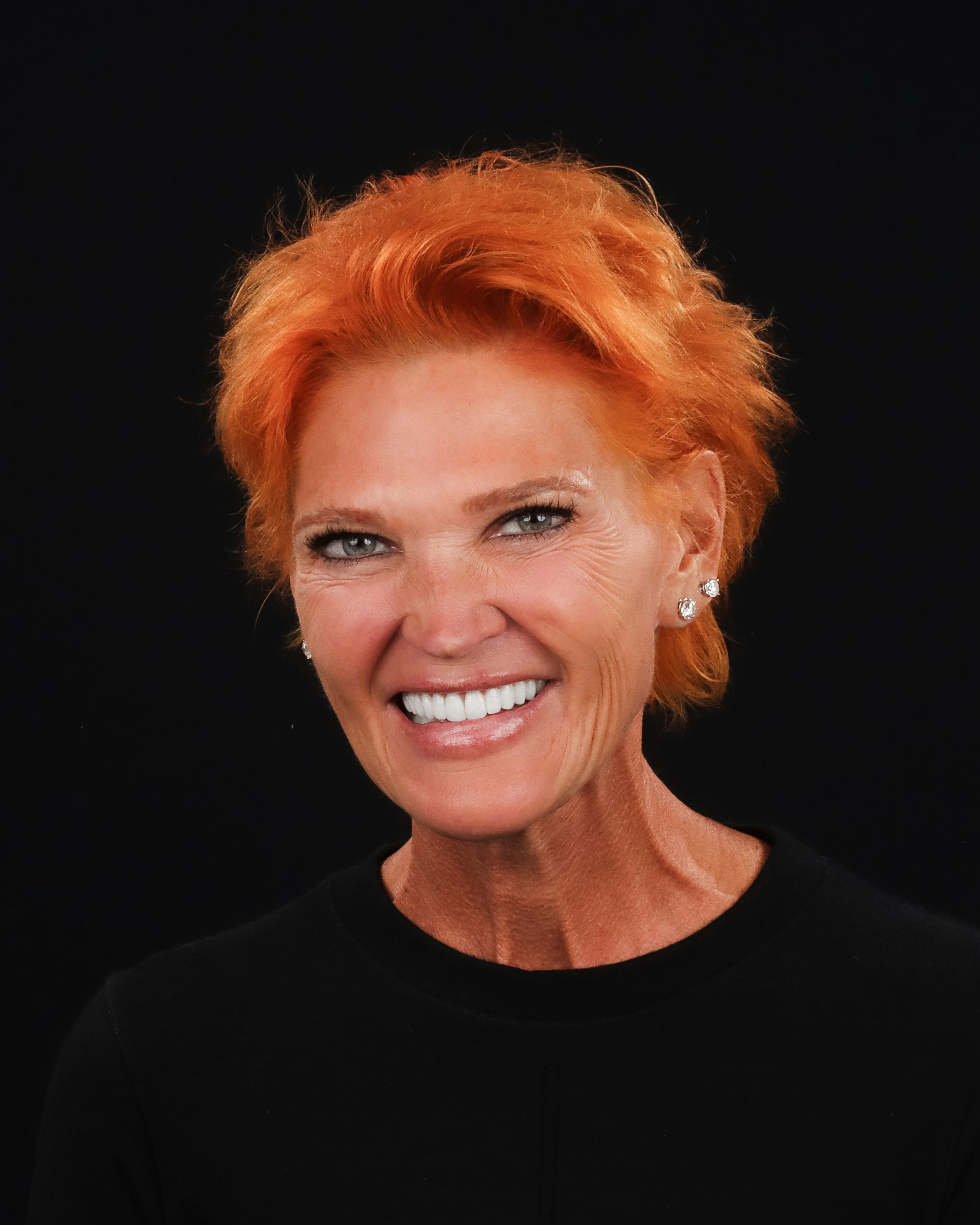 SmileOn Patient After