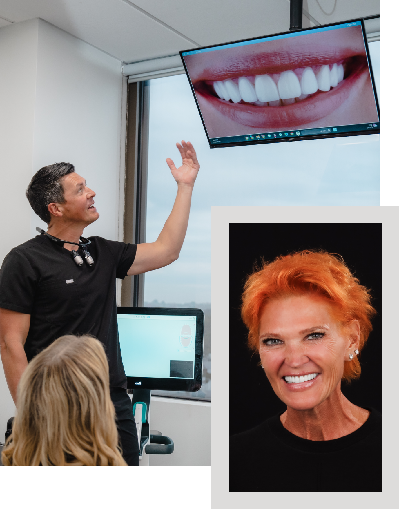 dental crown consult