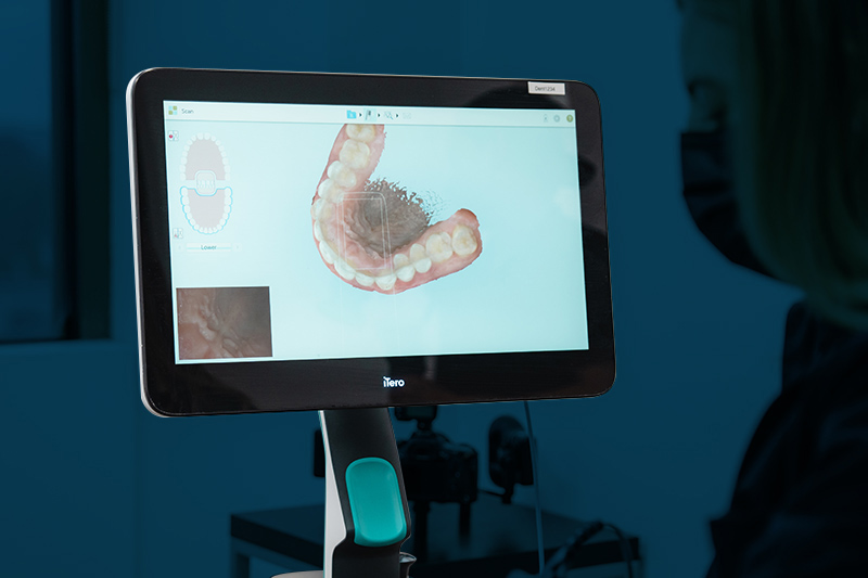 a 3d dental scan