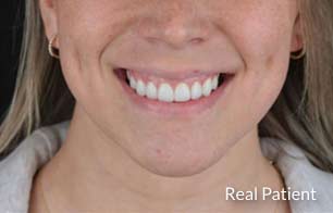 Beautiful smiling woman after cosmetic dentistry