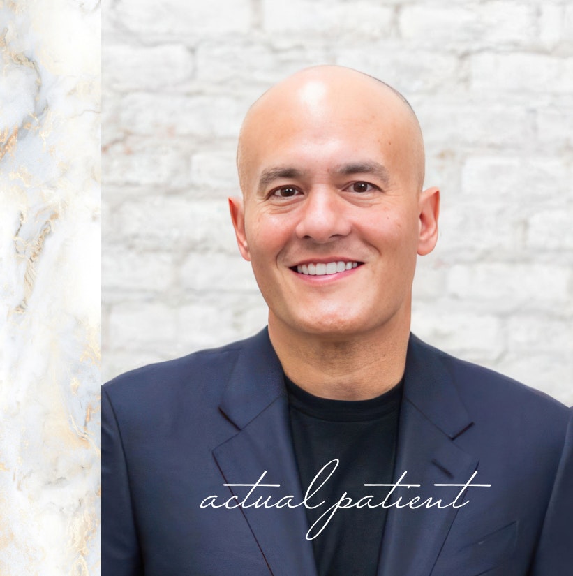 Smiling man after a smile makeover