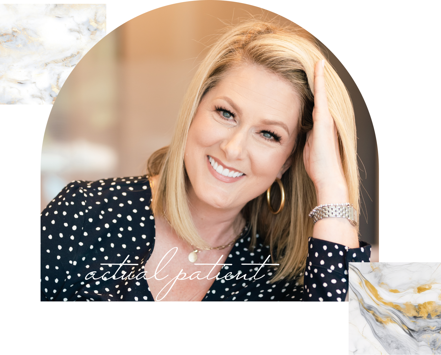 our real smiling patient