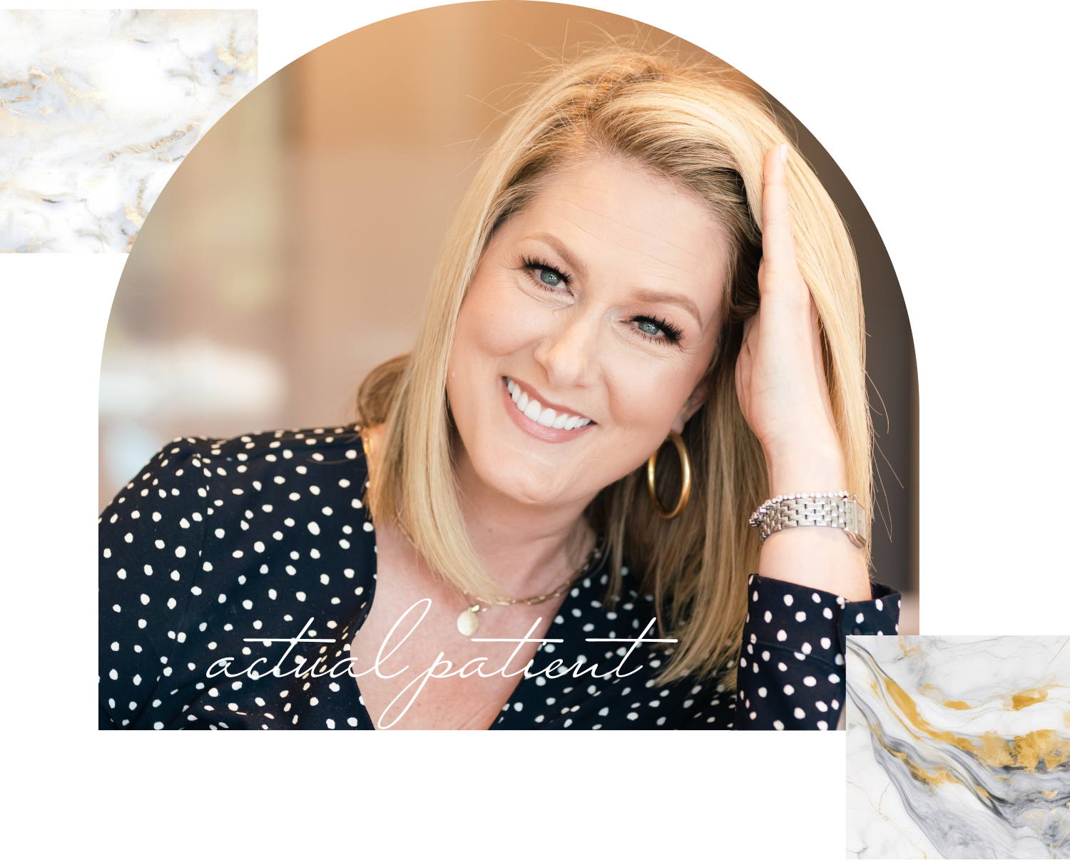 our real smiling patient