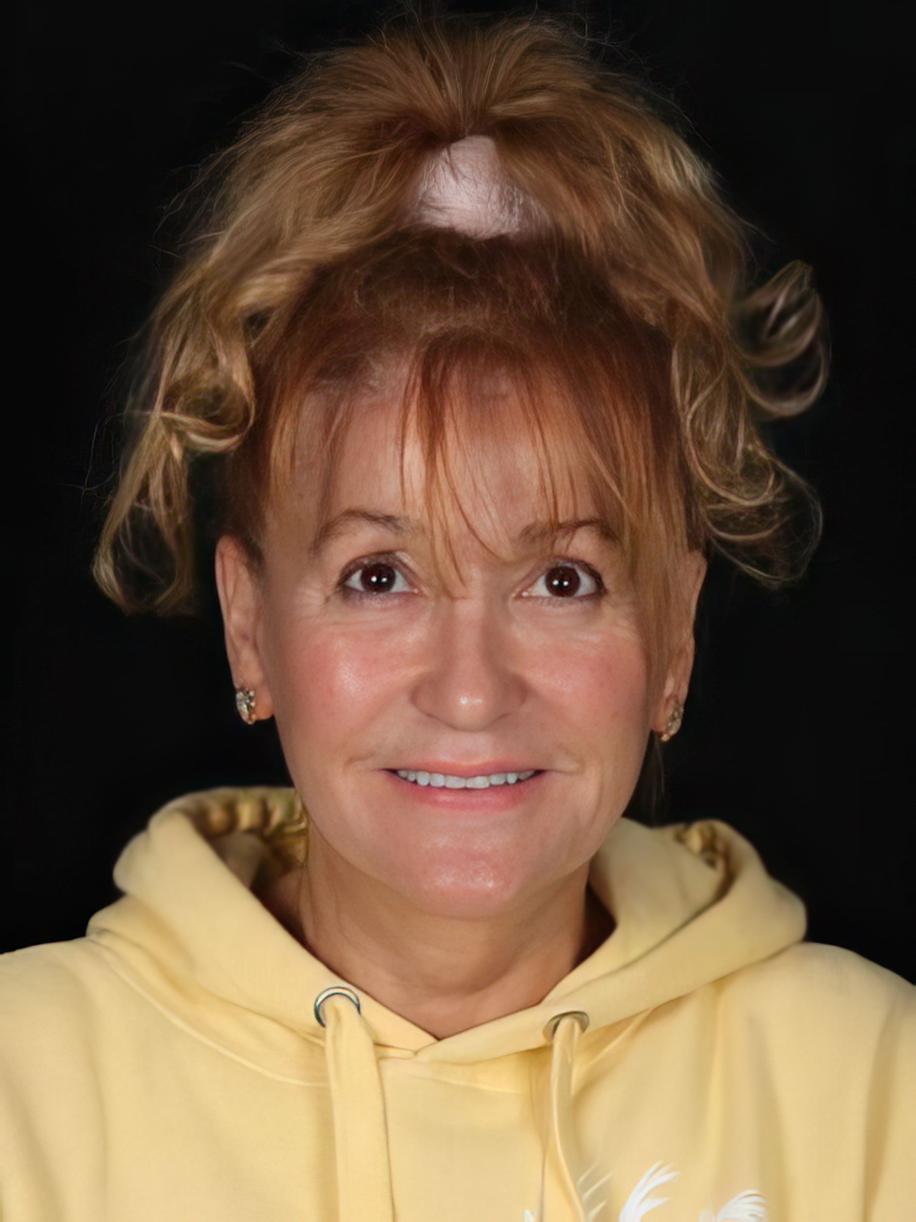 Dr. Scott Young's patient before veneers