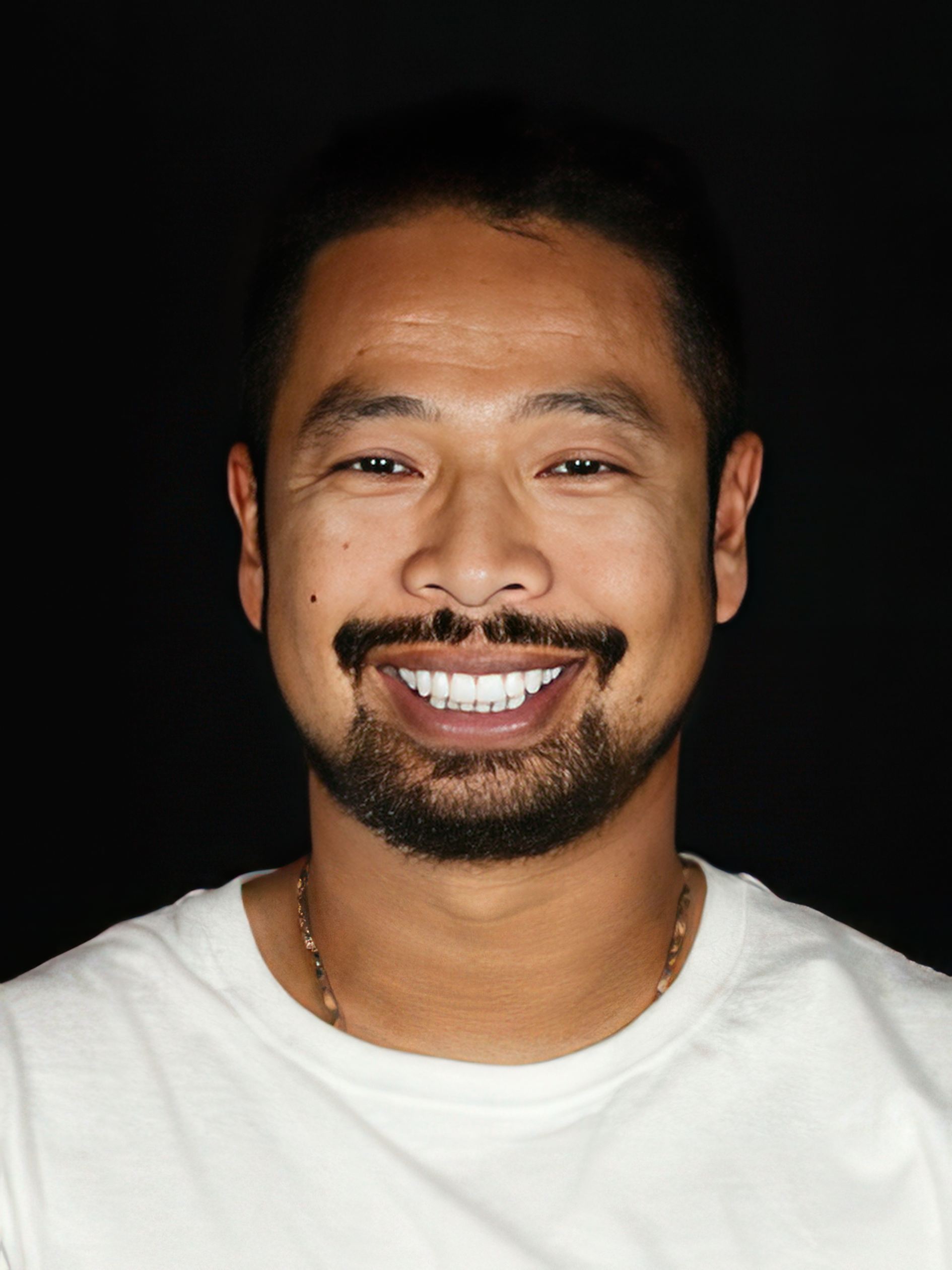 Dr. Scott Young's patient after veneers