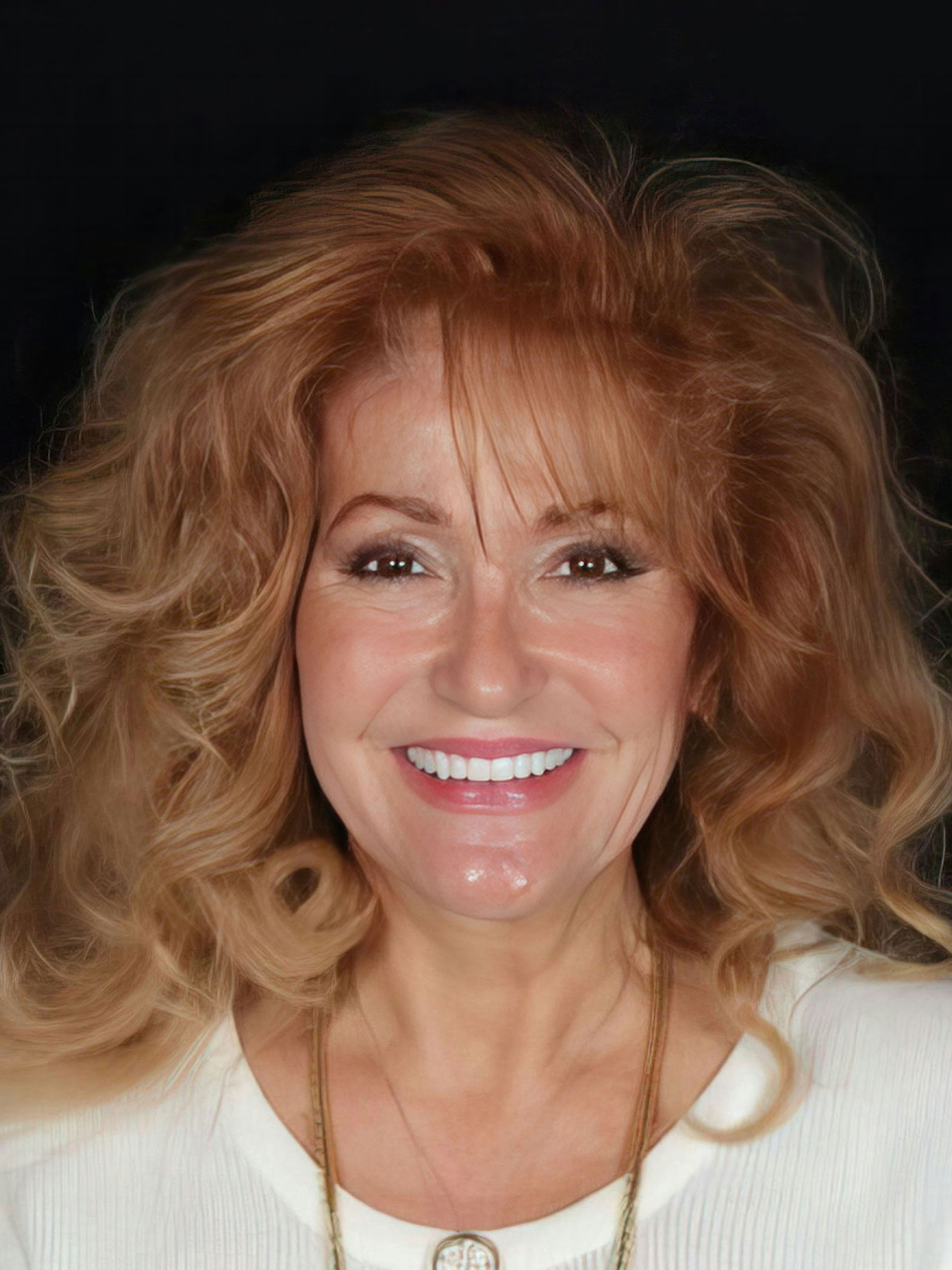 Dr. Scott Young's patient after veneers