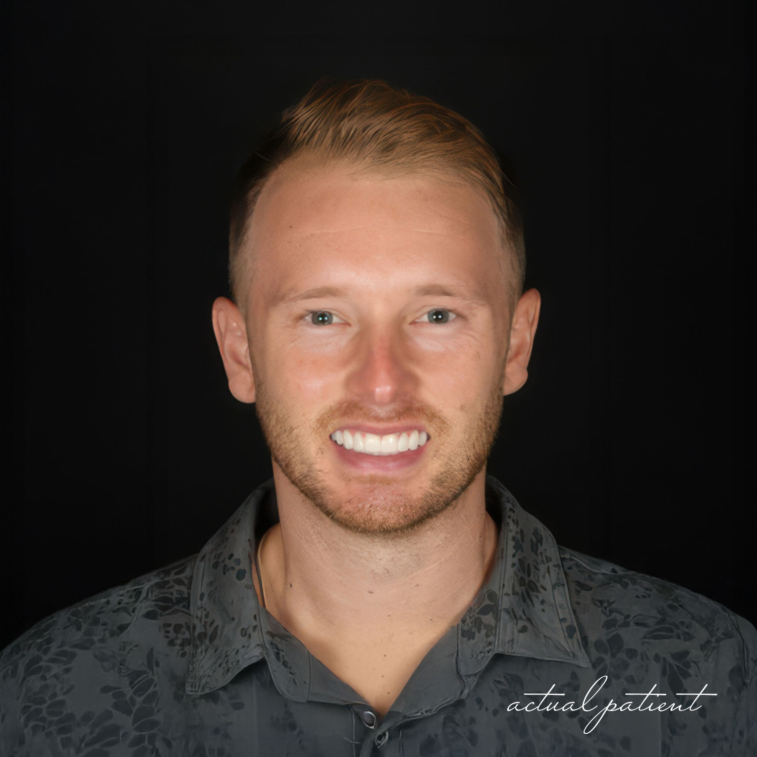 patient who had his teeth whitened