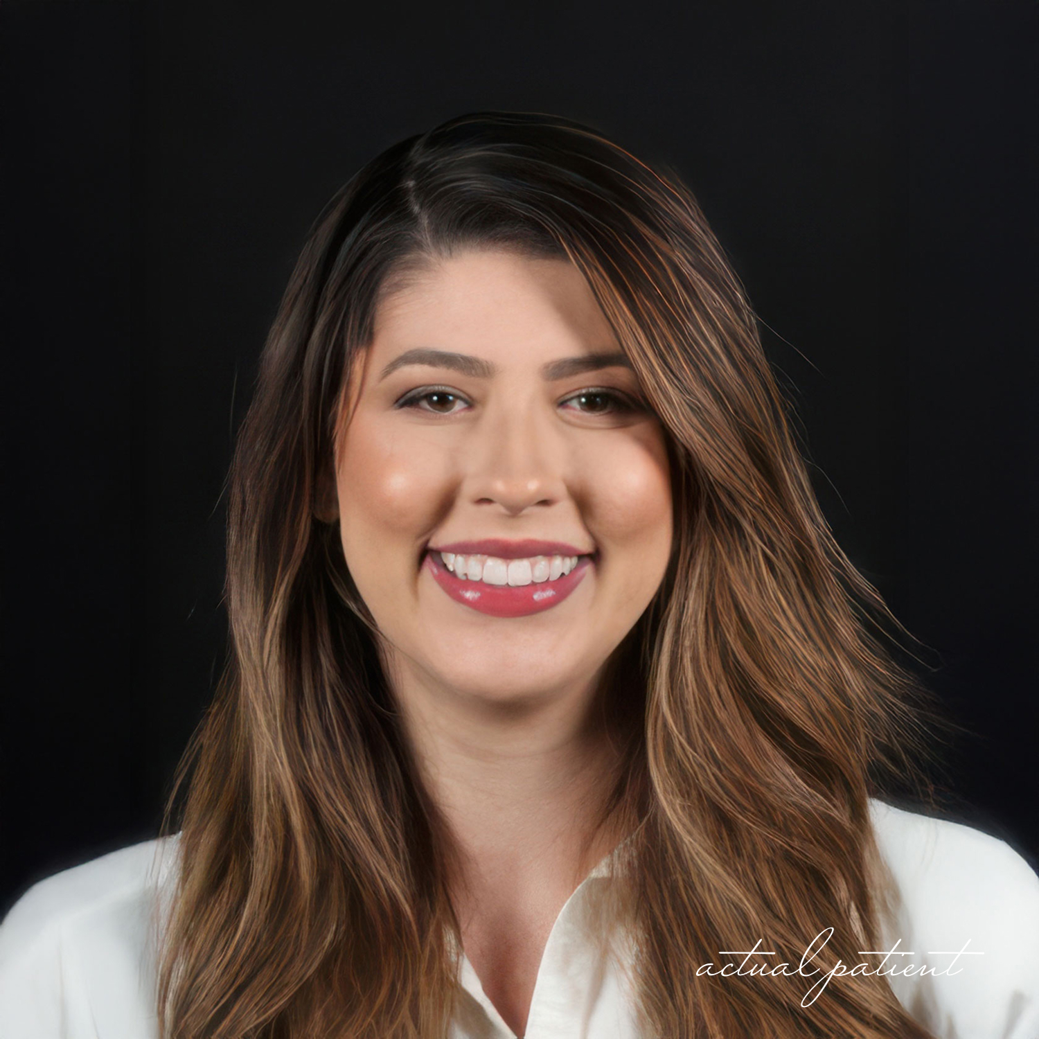 woman who got dental bonding