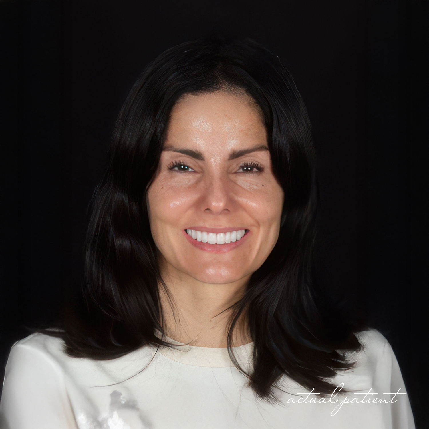 patient with veneers