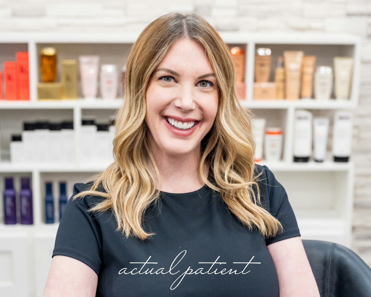 Actual Invisalign Patient