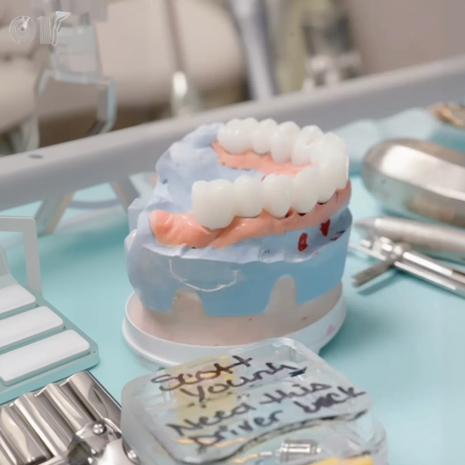 dental arch model