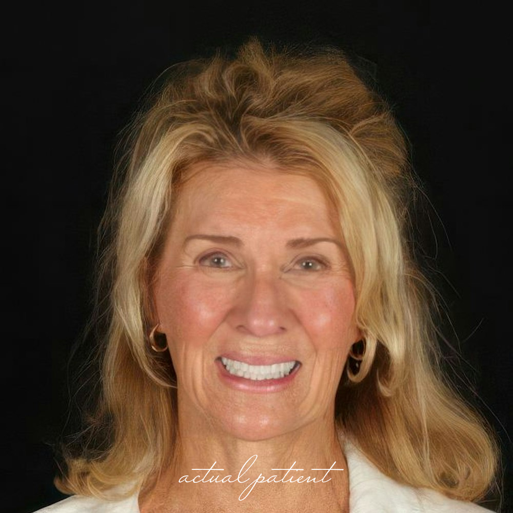 smiling patient with long blonde hair