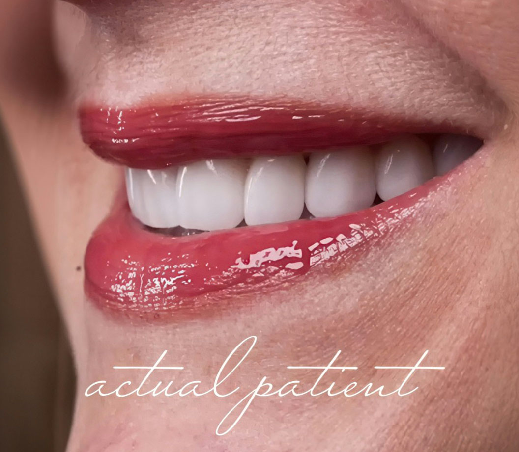 Close-up of woman’s lips showing natural pink tone and smooth texture