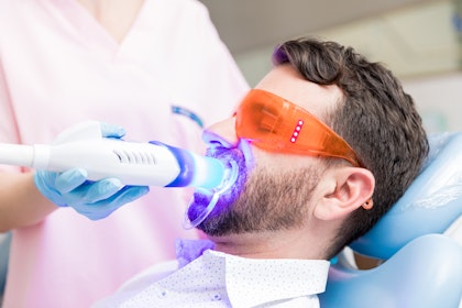 Man getting his teeth professionally whitened
