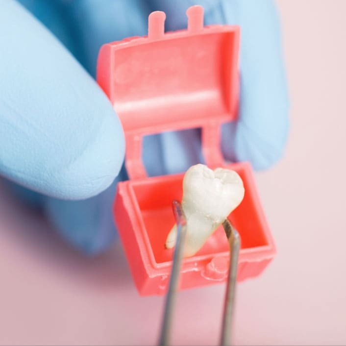 extracted tooth being placed in a container