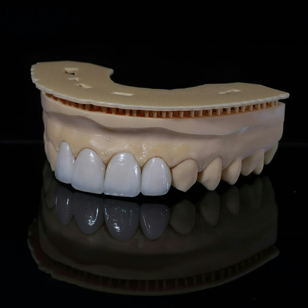 Veneers on model