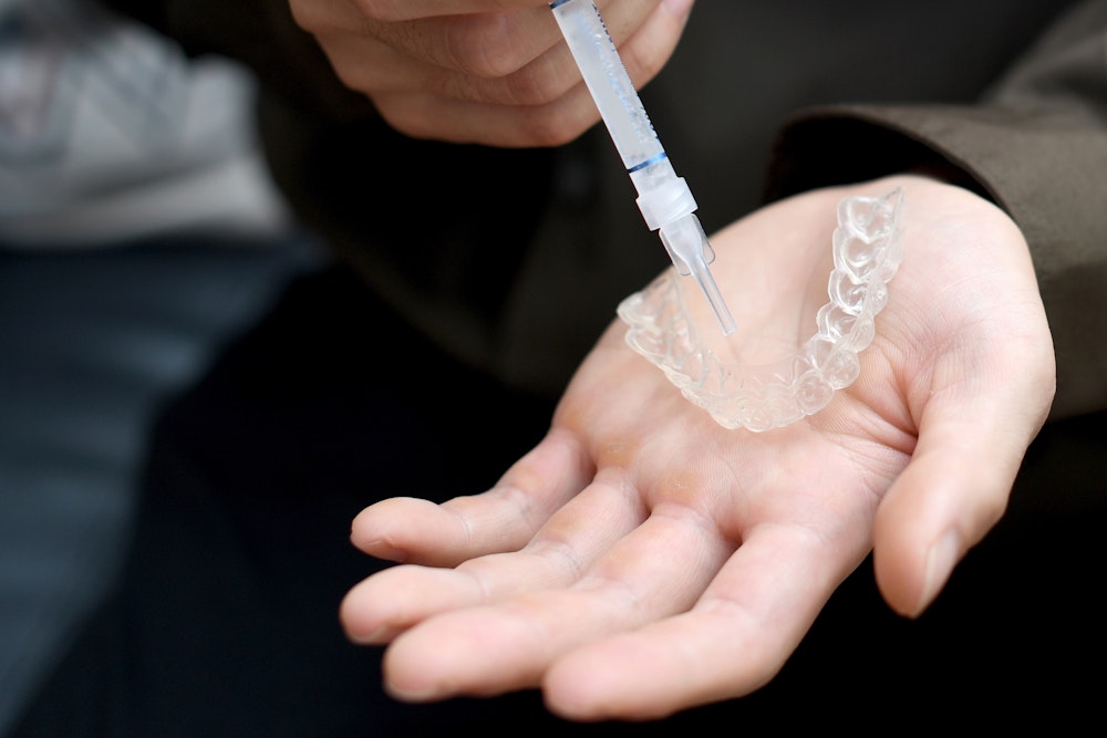 person filling tray with whitening gel