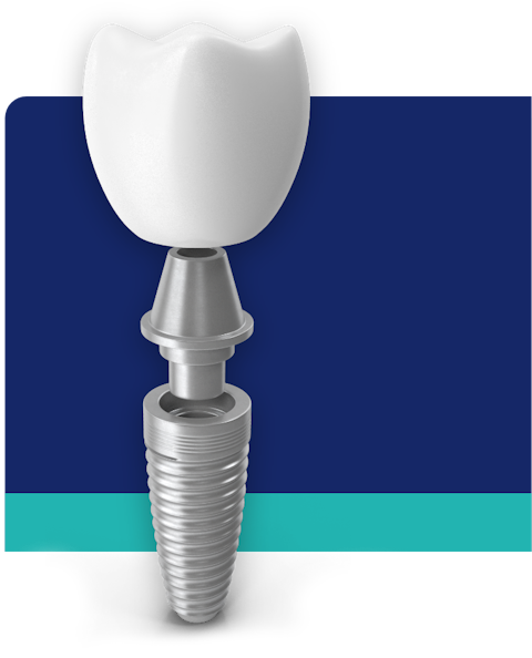 Implant crown