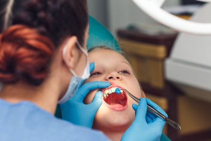 dentist applying fluoride to a child's teeth