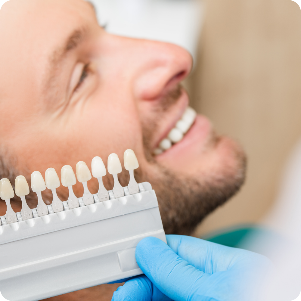 man reviewing veneer shades