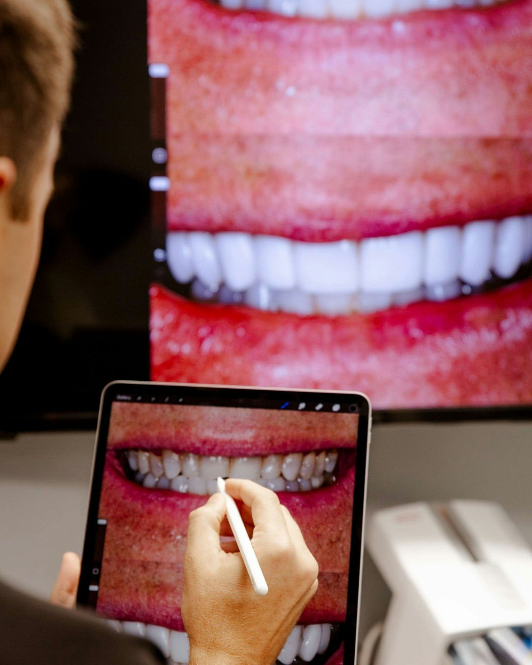 Dentist using a digital tablet to design a patient’s smile, with close-up images of teeth displayed on a screen.