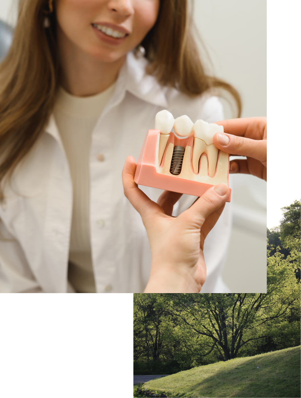 collage of bridge and dental implant in model and tree