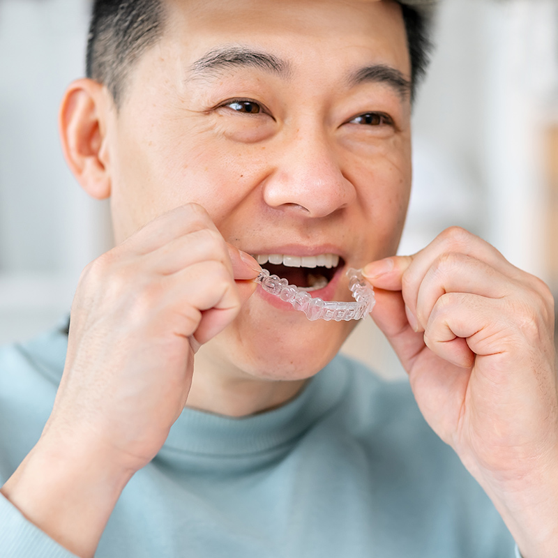 man putting on clear aligner