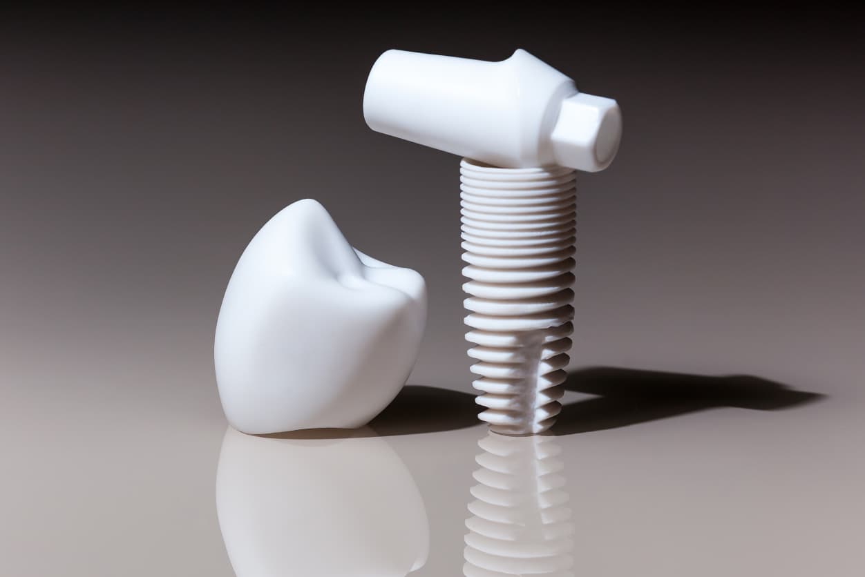 Ceramic implants