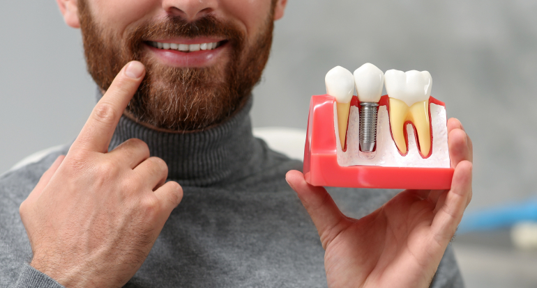 Smiling man holding dental implant model