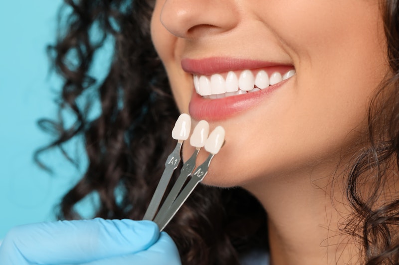 woman receiving veneers