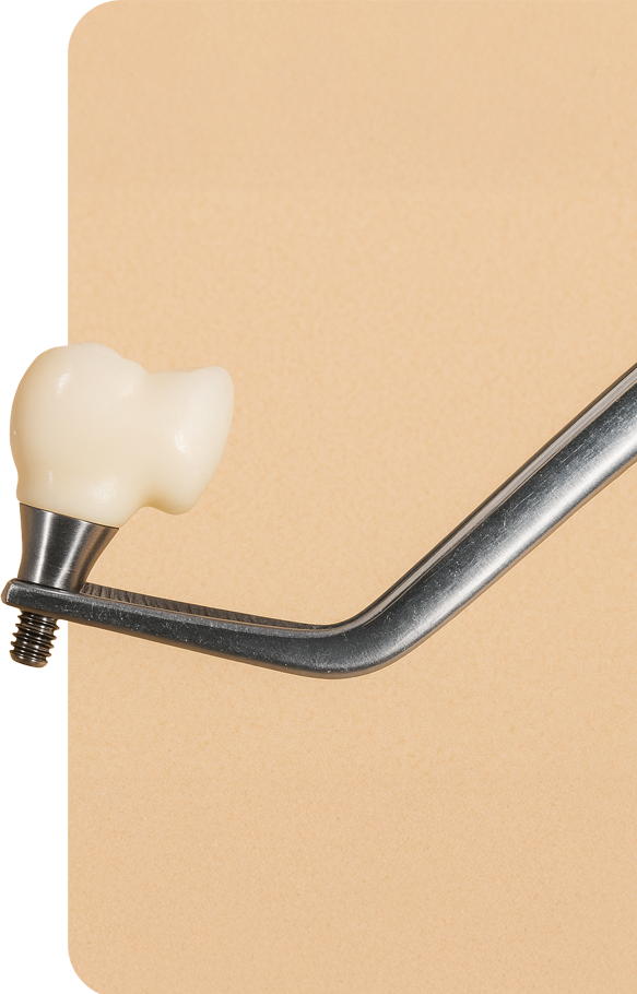 implant-supported crown