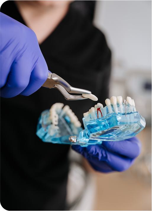 dentist demonstrating tooth extraction on dental arch model