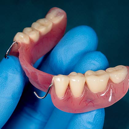 partial dentures