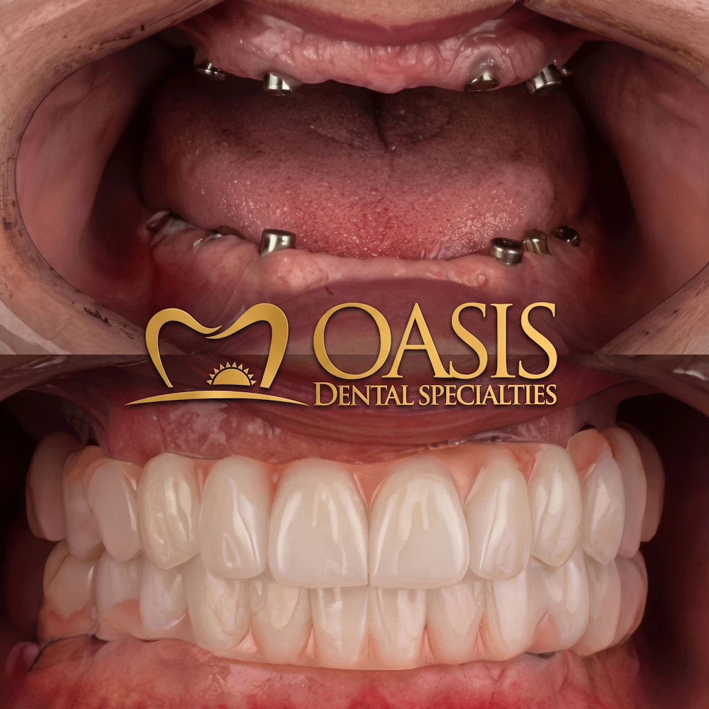 Before and After patient at Oasis Dental Specialties